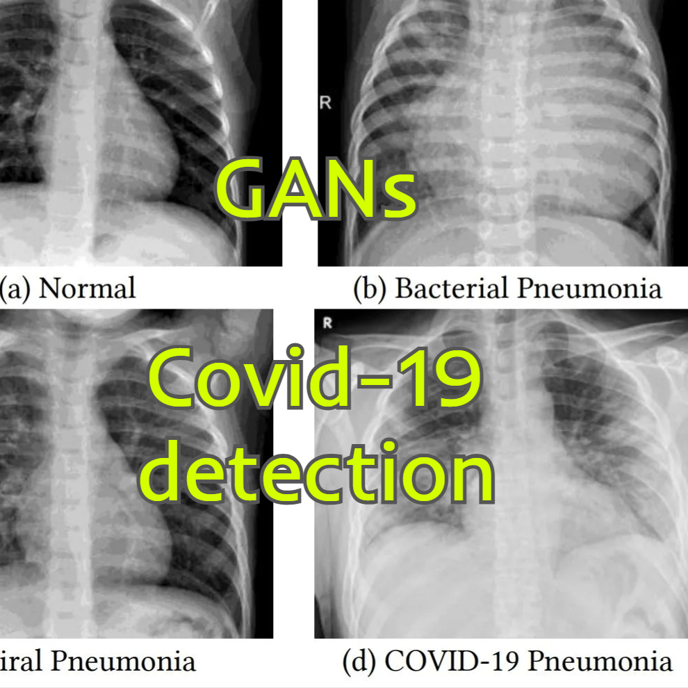 covid19 detection GANs